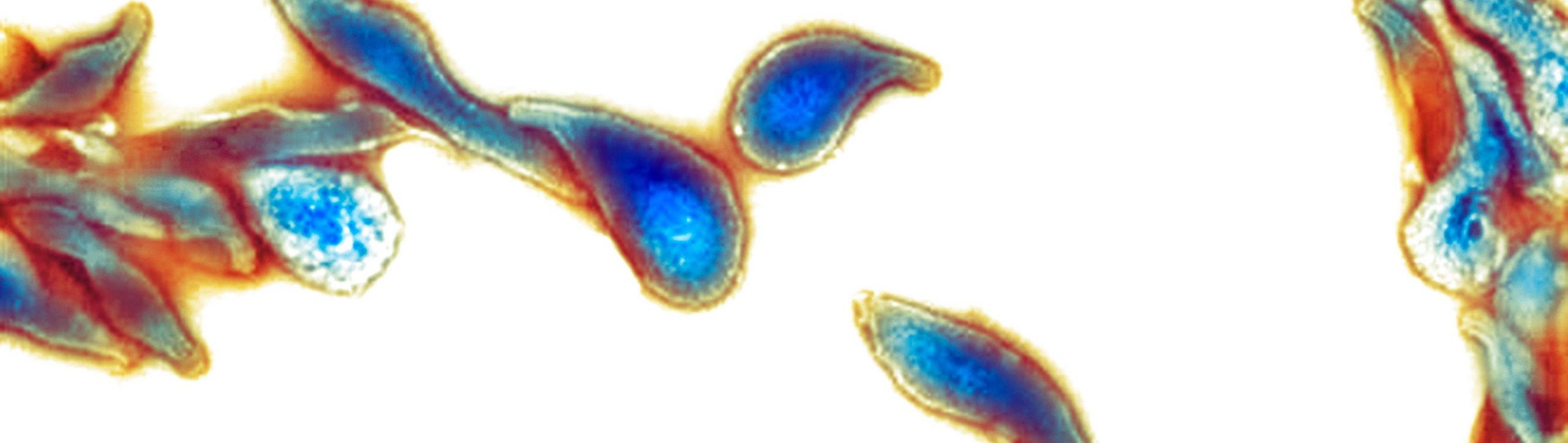 Mycoplasma genitalium bacteria, coloured transmission electron micrograph (TEM)