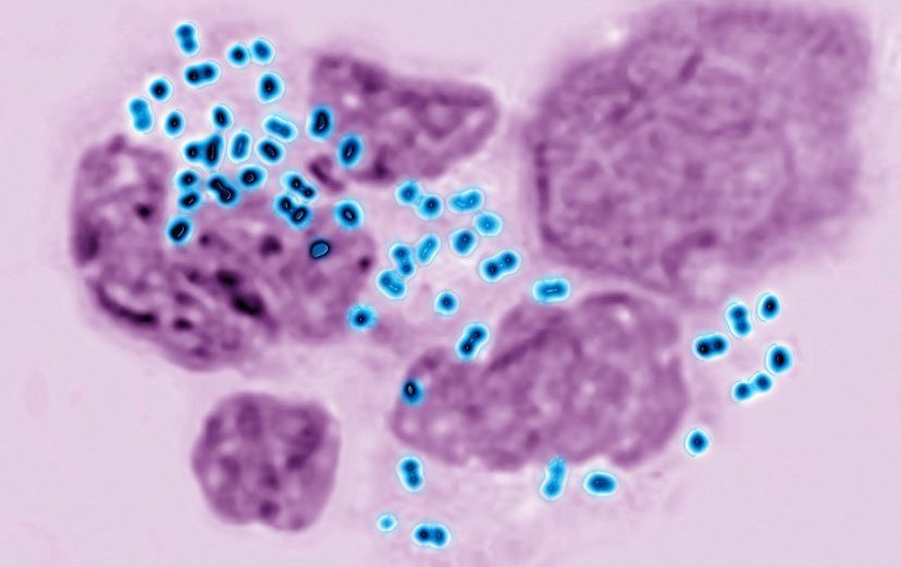 Microscopic image of Neisseria gonorrhoeae