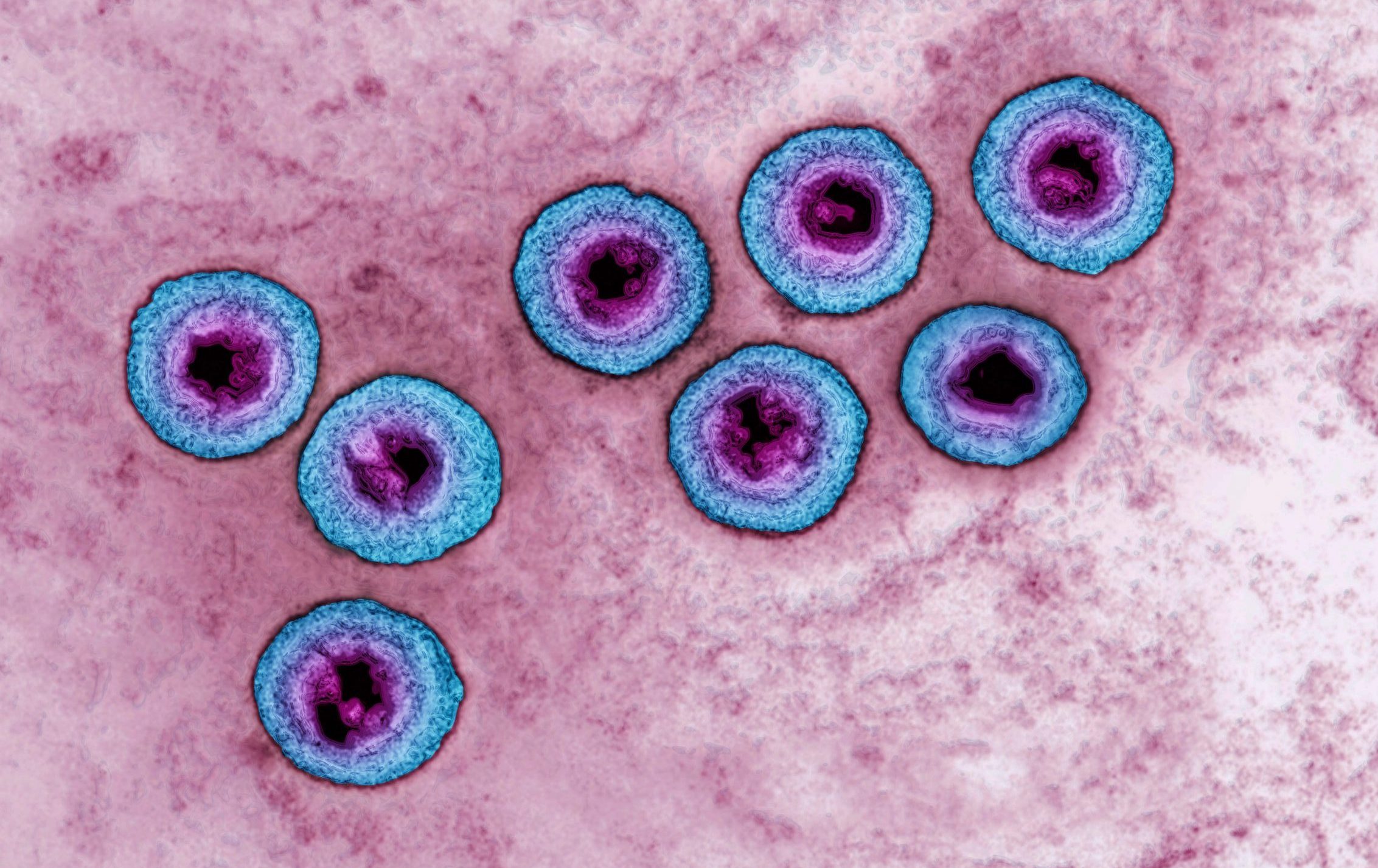 Microscopic image of Herpes Simplex Virus